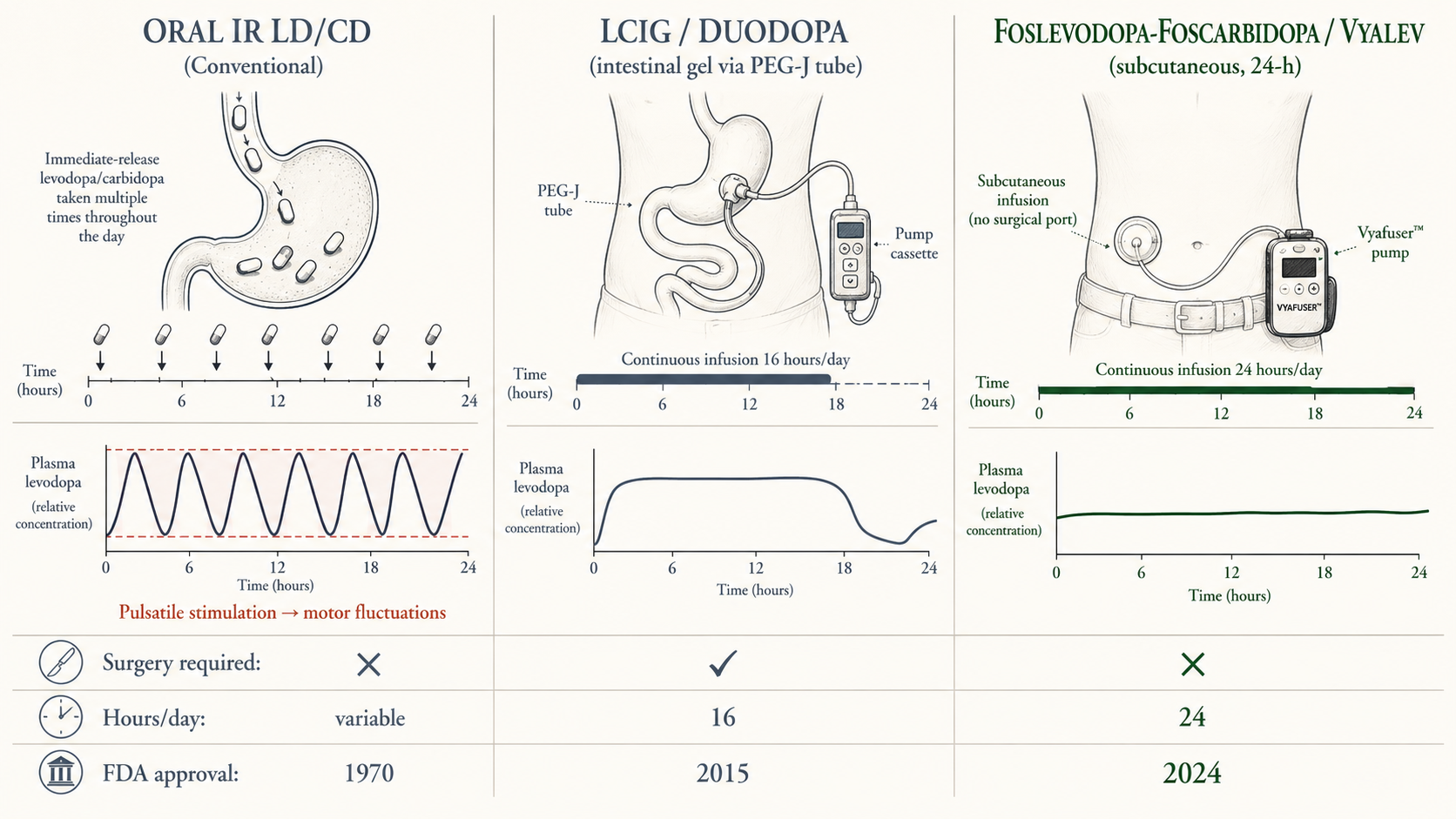 Figure 4 — Three modes of continuous-delivery levodopa: oral immediate-release (pulsatile) vs intrajejunal LCIG (Duodopa, PEG-J) vs subcutaneous foslevodopa–foscarbidopa pump (Vyalev / Produodopa, Vyafuser pump).